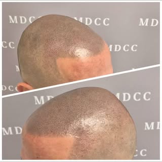 Après quelques années, une petite séance de rafraichissement s'impose afin de reviver le pigment.

#