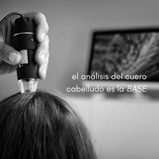 Una buena higiene capilar comienza con un buen análisis del cuero cabelludo

Gracias a nuestras micr
