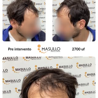 Scorri il carosello per scoprire il percorso e la trasformazione di questo nostro paziente, dopo 7 m