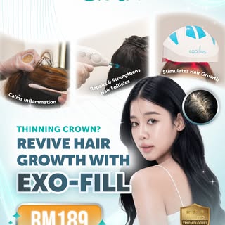 Noticing more scalp showing at your crown? 😟

Hair thinning doesn’t happen overnight, but neither d