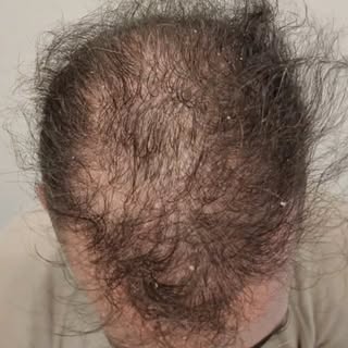 ¿Se acuerdan de este caso? 🤔
Lo publiqué hace unos meses mostrando el mal resultado y lo difícil qu