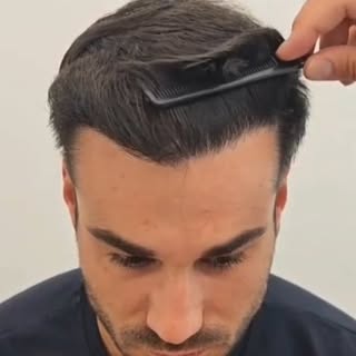 6 meses después… y el resultado habla por sí solo: PE-LA-ZO 🦁

✔️ Diseño natural
✔️ Densidad homogé