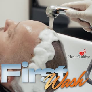 One of the most important stages after a hair transplant: the first wash.

In our new video, you can