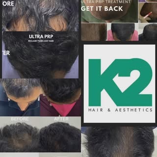 HAPPY MOMENTS when your work speaks well with consistent results. @k2hairaesthetics @k2hairaesthetic