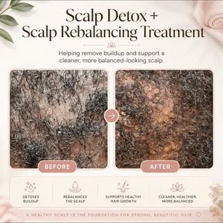 💕 The scalp tells a story—and this before-and-after shows the difference proper care can make!

In 