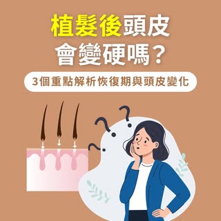 植髮後頭皮變硬緊繃？解析恢復期正常修復反應
影片快速看🎬
-
植髮後頭皮局部變緊變硬
常讓髮友感到好奇👀
ihair風華御髮專業團隊指出
這屬於微創手術後的正常恢復反應👍
頭皮因組織癒合與循環變