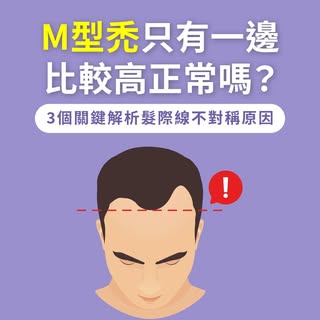😨 M型禿只有一邊比較高正常嗎？
影片快速看🎬>>https://youtu.be/qNlqdhIr0Tg
延伸閱讀📖>>https://www.ihairtransplantclinic.co