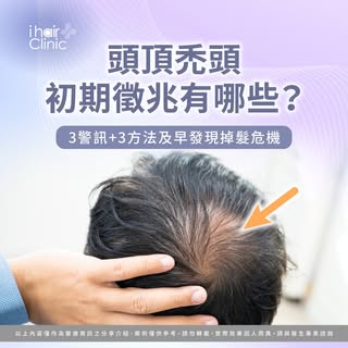 😱頭頂禿頭初期徵兆有哪些？3警訊+3方法及早發現掉髮危機
-
你最近洗頭時掉髮變多？🤔 
發現頭頂分線好像變寬了？
許多人在禿頭初期會忽視這些細微變化，以為只是暫時性掉髮
殊不知這些都是毛囊萎縮的