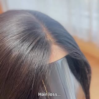 Are you struggling with hair loss?
You’re not alone!

Did you know that approximately 50% of women w
