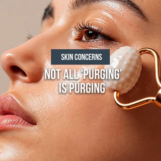 Started a retinoid/acid and breaking out?
📌 If it burns, itches, looks shiny-tight, or appears in b