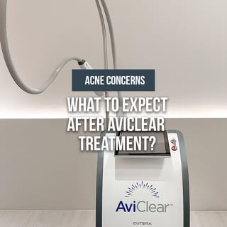 What to expect after AviClear ✨

Using a targeted 1726-nm wavelength, AviClear works deep inside the