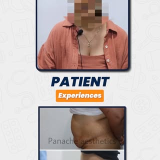 ✨ Every Transformation Begins With One Step ✨
Real patients, real stories, real confidence.
From upp