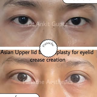 One of the most requested cosmetic procedures in the world — and the reason is in these results.

As