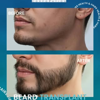 Reclaim your look — one hair at a time.
Uneven growth or patchy beard? You're not alone.
At Health a