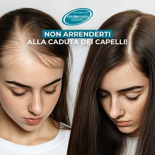 🌟 Dì addio alla calvizie e all’alopecia: soluzioni mirate per le donne! 🌟

La caduta dei capelli p