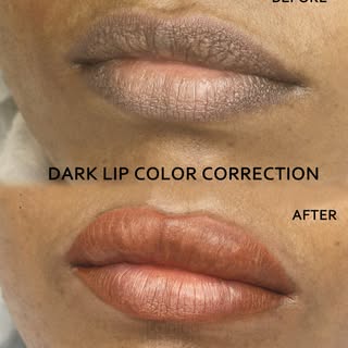 Enhance your lips naturally with our advanced Lip PMU services at Lanina Aesthetics, Ahmedabad. From