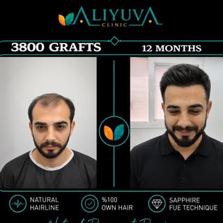 ✨ A confident smile starts with natural results.

This amazing transformation was achieved with a 38