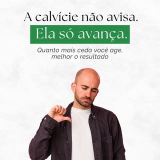 Tem uma coisa que quem convive com a calvície sabe bem: ela não chega de uma vez. Vai aos poucos, em