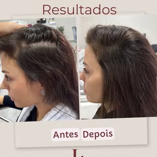 Você está com queda de cabelo? Quer recuperar o cabelo perdido?

Agende sua consulta (14)99684-5445