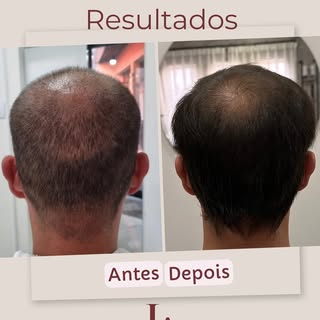 Aquele antes e depois que anima demais 😁