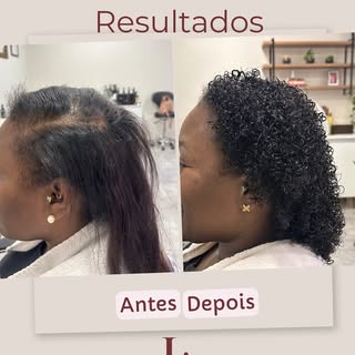 Quero dividir com vocês essa história linda de viver, um tratamento que está completando 18 meses.
E