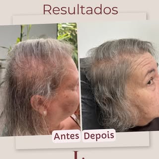 Terapia capilar além de cuidado, é melhora da autoestima