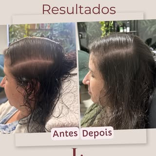Sobre melhorar a saúde do couro cabeludo e por consequência seu cabelo.
A terapia capilar te ajuda c