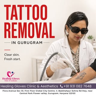 ✨ Tattoo Removal in Gurugram ✨

Ready to let go of unwanted tattoos and start fresh?

At Healing Glo