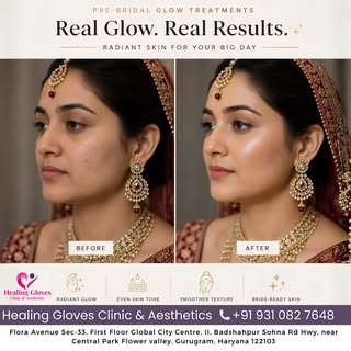 ✨ Every bride deserves to glow with confidence.

Your bridal glow isn't created with makeup alone—it