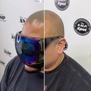2-3 session can change your life. 

#smp #scalpmicropigmentation #scalptattoo
