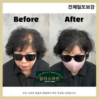 탈모란 마음의 병을
계속 가리느라 위축되고 계신가요?

어떤 부위던 탈모고민에서
벗어날수 있도록 감쪽같게 만들어드려요!

가르마, 정수리, 구렛나루, 흉터
땜빵, 삭발, 전체 모든