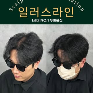 어느각도에서도 자연스럽게
탈모 스트레스를 두피문신으로 
해결해드렸습니다!
_________________________

강남 일러스라인 대표도 받았습니다!

예약 문의는 프로필 