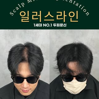 광범위한 가르마 탈모로 인해
두피문신을 고민하다가
일러스라인을 방문해주신 고객님

이제는 어느 방향에서 봐도
자연스러운 두피문신을 해드렸습니다!
___________________