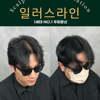 가르마 탈모에 두피문신만한게 없죠.
효과있게 당당하게 만들어드렸습니다!
_________________________

강남 일러스라인 대표도 받았습니다!

예약 문의는 프로필 상