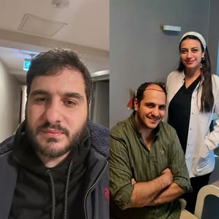 Hair transplant surgery has become a priority choice to those who are anxious to restore their hair 