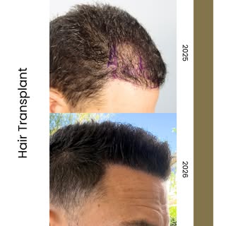 We would like to sincerely thank our patient for the trust he placed in Dr. Espinosa Custodio and fo
