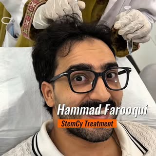 ✨
Hammad Farooqui has started his STEMCY Hair Regrowth Treatment journey with Dr. Hanif Saeed. Here'