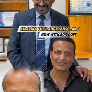 A major FUE hair restoration journey focused on achieving a fuller look, natural hairline, and long-
