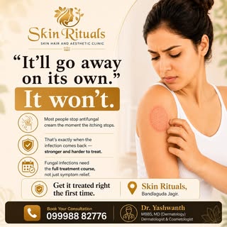 Itching stopped doesn't mean infection gone.

Stopping antifungal cream early is the no 1 reason fun