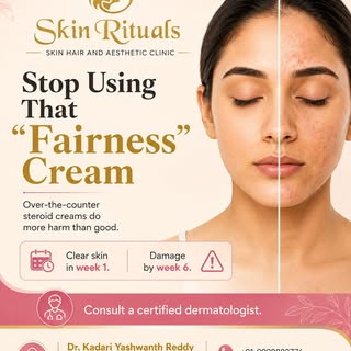 ⚠️ Stop Using "Fairness" Creams!

That instant glow may come at the cost of long-term skin damage. C