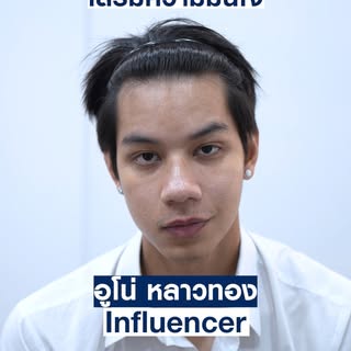 ผมมันเริ่มกิน หรือผมกินผมก็ไม่รู้ [ อูโน่ หลาวทอง - Youtuber ] ปลูกผมที่ MaxHair สร้างความมั่นใจเวลา