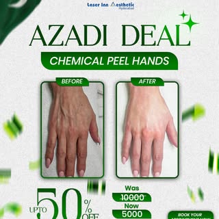 ✨ Don’t let your hands reveal your age!

Refresh the look of your hands with our Chemical Peel Hands