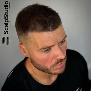 Density & Definition 🔥

Available in both our Glasgow and Marbella studios – same expert team, same