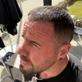 A clean, defined hairline and fuller-looking scalp - 100% natural finish 😮‍💨☀️ 

Whether you’re de