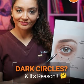 🚫No cream will work on dark circles unless you fix the actual cause. 👀⚠️

Dark circles are one of 