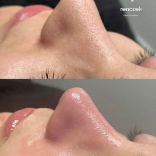 Una limpieza facial profesional va mucho más allá de la estética: ayuda a eliminar impurezas, célula