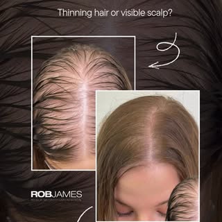 ✨ Just 1 seat left! ✨
Beginners welcome - no prior experience needed.

Scalp Micropigmentation Train
