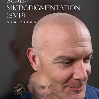 Some changes don’t need to be obvious to make a big impact.

Scalp Micropigmentation (SMP) is design