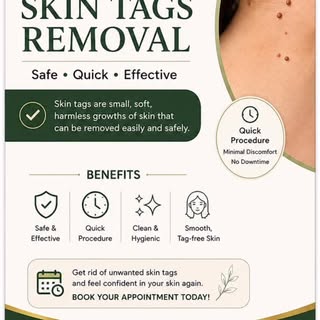 #skintags#lasertreatment #ambaladoctor#healthyskin