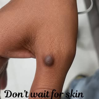 #ambala #dermatologist #drnitishjain #mannathospital #bookyourappointment